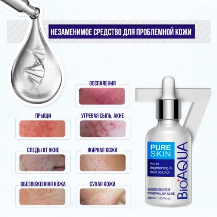 Сыворотка BioAqua Pure Skin Removal of acne 30ml Оптом
