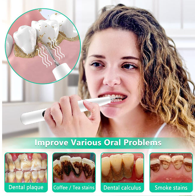 Ультразвуковой Зубной Скалер Home Use Dental Tools Оптом